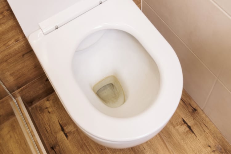 Toilet Water Yellow
