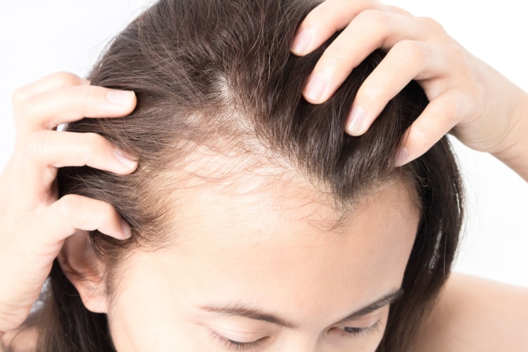 Can Hard Water Cause Hair Loss?